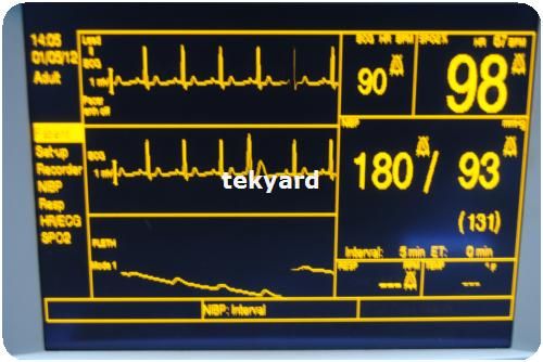 DATASCOPE PASSPORT XG 0998 00 0134 N44 MULTI PARAMETER PATIENT MONITOR 